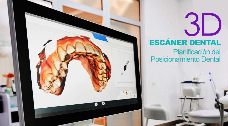 Escáner dental 3D