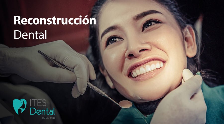 Reconstrucción dental