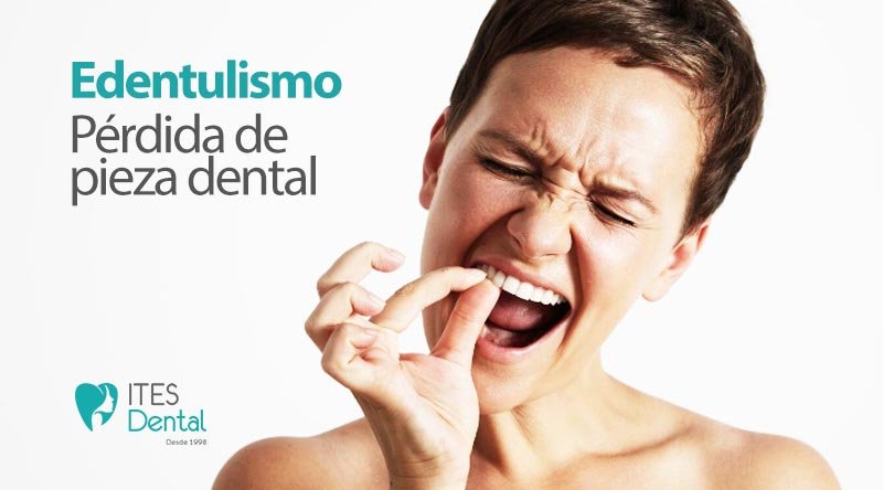 Edentulismo o perdida de dientes