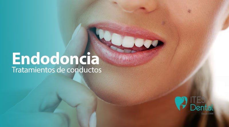 Endodoncia tratamientos de conductos