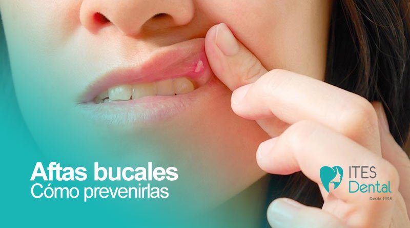 aftas bucales